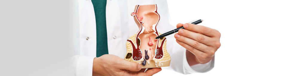 hemorrhoids42-1024x256